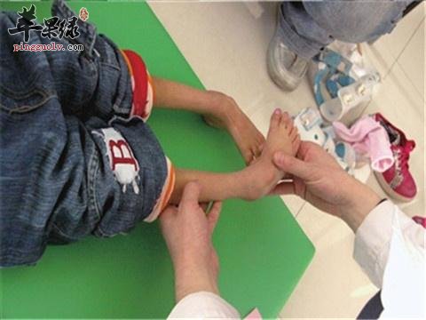 孩子们脑瘫早期症状表现有哪些  第4张