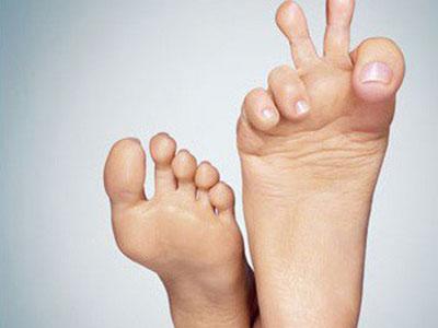 秋季如何调养脾胃 这样做效果好  第1张