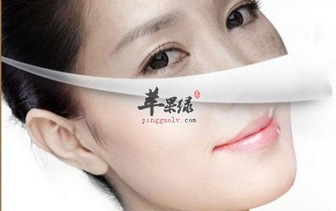 女性祛斑的偏方有哪些  第2张