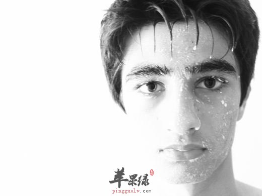 炎热的夏季易出汗 这些情况要注意  第2张