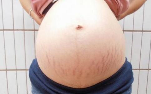 妊娠纹判断生男生女的方法  第3张