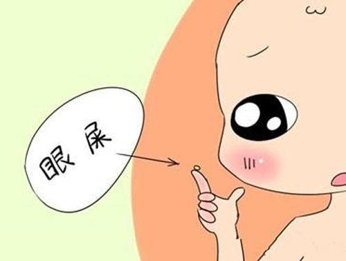 新生儿眼屎多是怎么回事