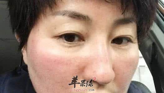 饮食调理祛色斑的方法  第2张